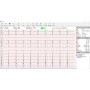 ECG CARDIOMATE 6 Spengler