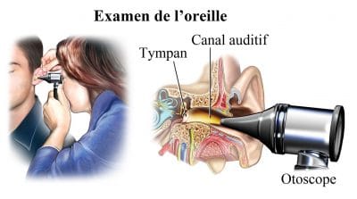 Examen médical de l'oreille avec diapason et otoscope